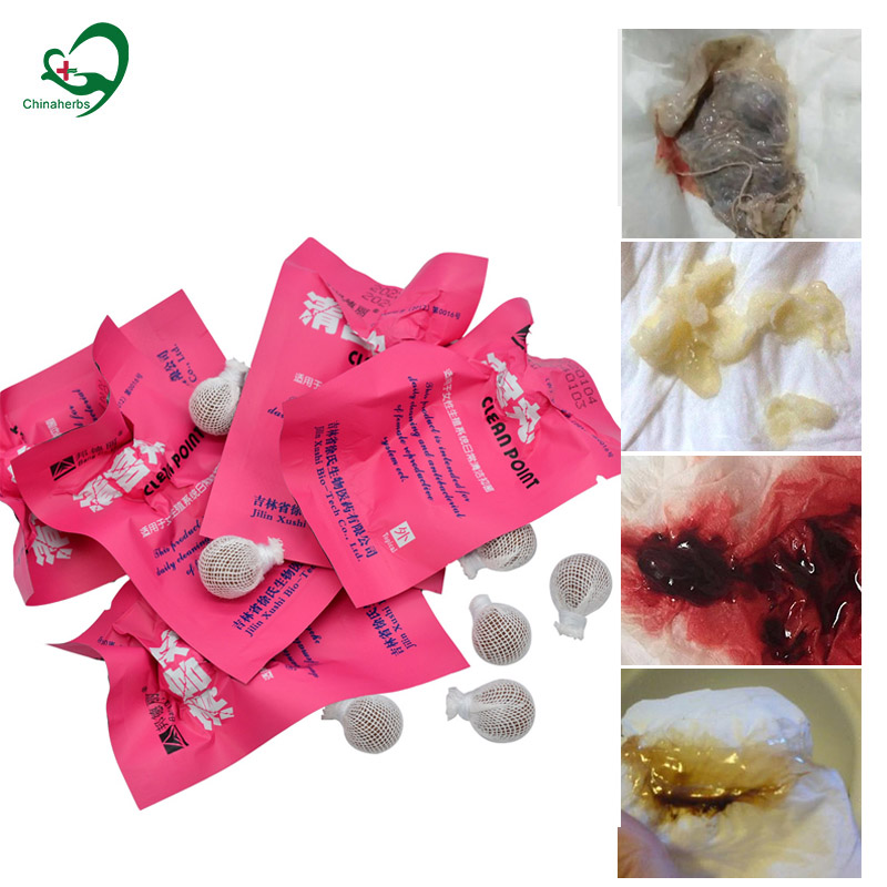 20pcs Yoni Pearls Clean Point  - Medical Wellness & Spa Werona 评论和价格